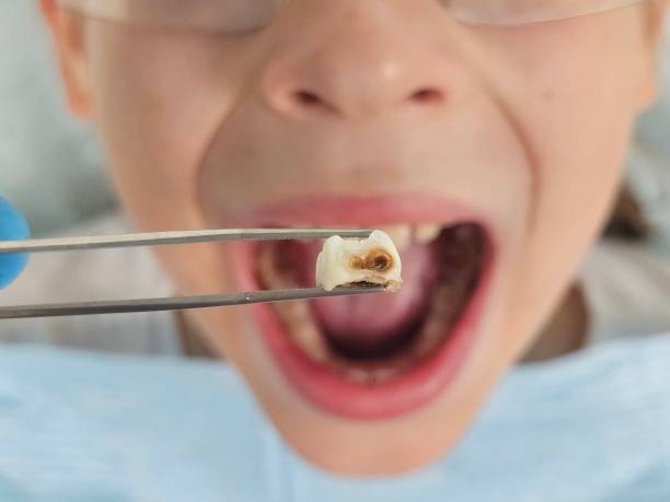 Emergency Dentist for Kids in NE